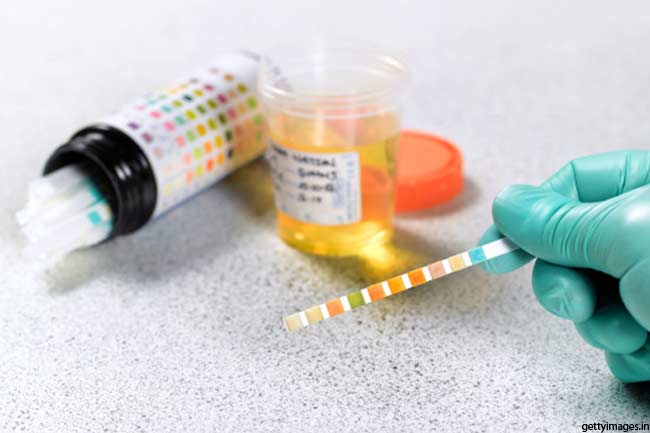 Blood in Urine